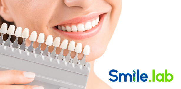 Косметическое отбеливание зубов в студии ослепительных улыбок Smile Lab. **Скидки до 75%**. Санкт-Петербург - kupikupon.ru Косметическое отбеливание зубов в студии ослепительных улыбок Smile Lab. **Скидки до 75%**