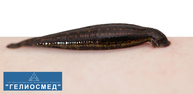 1, 3 или 5 сеансов гирудотерапии в многопрофильной медицинской компании «Гелиосмед». **Скидка до 55%**