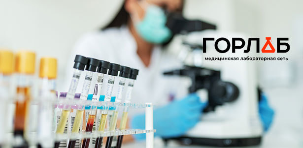 Комплексное исследование крови в медицинской лаборатории «Горлаб» на «Ясенево»: «Биохимия крови», «Обследование щитовидной железы», «Онкологический комплекс для женщин» и не только. **Скидка 50%**