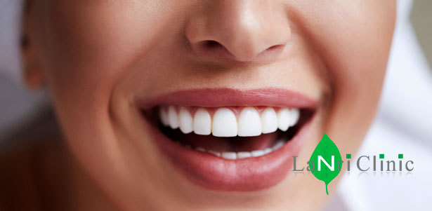 **Скидка до 70%** на программу годового стоматологического обслуживания, установку брекет-системы и керамического винира в центре эстетической стоматологии Lanri Clinic