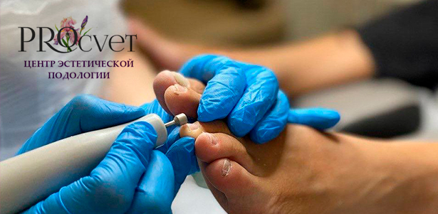 **Скидка 50%** на подологический педикюр и установку титановой нити + **скидка 40%** на все остальные услуги Центра эстетической подологии PROcvet