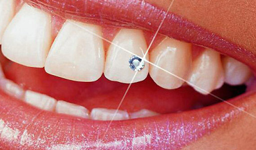 Попробуйте бриллианты на зуб! <font color="#759300"><b>Скидка 70%</b></font> на установку скайсов для зубов Swarovski в стоматологической клинике «Омега»: заплатите <font color="#759300">300 рублей вместо <s>1000</s></font>